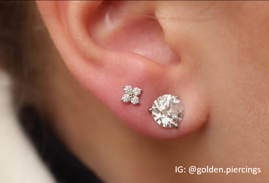 Cluster Quadrinity with Gemstone